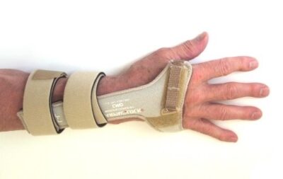 FERULA CARPAL LOCK